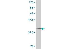 Western Blot detection against Immunogen (37 KDa) . (EYS 抗体  (AA 309-407))
