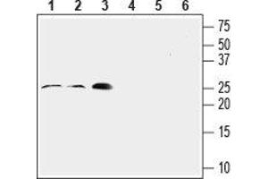 Western blot analysis of rat lung (lanes 1 and 4, 1:200), mouse heart (lanes 2 and 5, 1:200) and rat aortic endothelial cell (RAEC) (lanes 3 and 6, 1:400) lysates: - 1-3. (RAMP2 抗体  (Extracellular, N-Term))