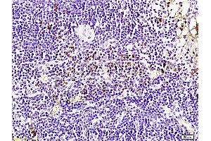 Formalin-fixed and paraffin embedded rabbit pancreas labeled with Anti-Bcl-2 Polyclonal Antibody, Unconjugated (ABIN707156) followed by conjugation to the secondary antibody and DAB staining (Bcl-2 抗体  (AA 161-239))