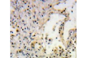 Used in DAB staining on fromalin fixed paraffin-embedded Lung tissue (SCGB1A1 抗体  (AA 21-96))