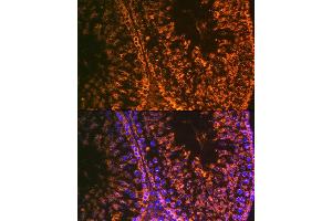 Immunofluorescence analysis of rat testis using Lin28 Rabbit mAb (ABIN7268266) at dilution of 1:100 (40x lens). (LIN28A 抗体)