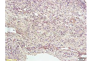 Formalin-fixed and paraffin embedded rat bile duct tissue labeled with Anti-CD34 Polyclonal Antibody, Unconjugated (ABIN676898) at 1:200 followed by conjugation to the secondary antibody and DAB staining