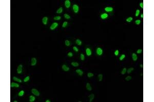 Immunofluorescence staining of Hela cells with ABIN7127487 at 1:25, counter-stained with DAPI. (Recombinant FEN1 抗体)