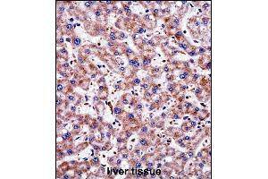 Immunohistochemistry (Paraffin-embedded Sections) (IHC (p)) image for anti-Transgelin 2 (TAGLN2) (AA 136-165), (C-Term) antibody (ABIN657984)