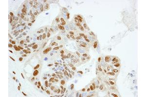 Immunohistochemistry (IHC) image for anti-Karyopherin (Importin) alpha 4 (KPNA4) (AA 471-521) antibody (ABIN7448983) (KPNA4 抗体  (AA 471-521))