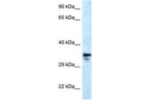 Image no. 1 for anti-Methylmalonic Aciduria (Cobalamin Deficiency) CblC Type, with Homocystinuria (MMACHC) (AA 190-239) antibody (ABIN6747634)
