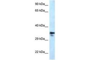 Image no. 1 for anti-Methylmalonic Aciduria (Cobalamin Deficiency) CblC Type, with Homocystinuria (MMACHC) (AA 190-239) antibody (ABIN6747634) (MMACHC 抗体  (AA 190-239))