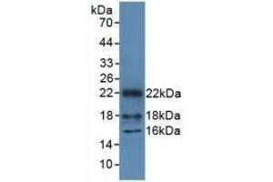 Detection of Recombinant HMGN1, Mouse using Polyclonal Antibody to High Mobility Group Nucleosome Binding Domain Protein 1 (HMGN1) (HMGN1 抗体  (AA 1-96))