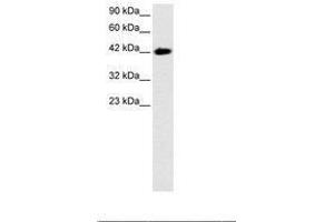 Image no. 3 for anti-BarH-Like Homeobox 2 (BARHL2) (AA 165-214) antibody (ABIN6735794) (BARHL2 抗体  (AA 165-214))