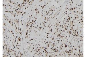 ABIN6273024 at 1/100 staining Human gastric tissue by IHC-P. (USP39 抗体  (N-Term))