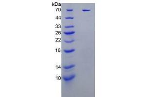 SDS-PAGE analysis of Human KIR2DL1 Protein.