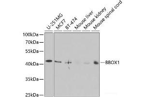 Western blot analysis of extracts of various cell lines using BBOX1 Polyclonal Antibody at dilution of 1:1000.