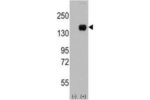 Western blot analysis of ASK1 antibody and 293 cell lysate (2 ug/lane) either nontransfected (Lane 1) or transiently transfected with the MAP3K5 gene (2).