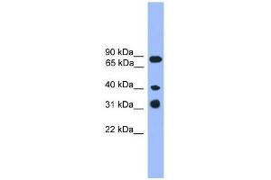 Western Blot showing LAX1 antibody used at a concentration of 1-2 ug/ml to detect its target protein. (LAX1 抗体  (C-Term))