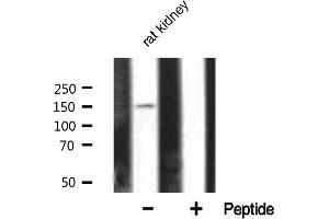Western blot analysis of PLCG1 expression in rat kidney tissue lysates,The lane on the right is treated with the antigen-specific peptide. (Phospholipase C gamma 1 抗体)