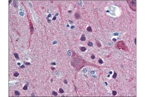 Human Brain, Cortex: Formalin-Fixed, Paraffin-Embedded (FFPE)