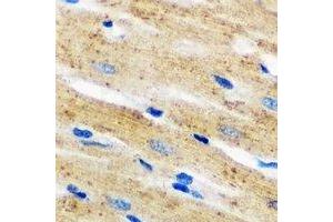 Immunohistochemical analysis of p67 phox staining in mouse heart formalin fixed paraffin embedded tissue section. (NCF2 抗体)