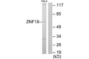 Western Blotting (WB) image for anti-Zinc Finger Protein 18 (ZNF18) (Internal Region) antibody (ABIN1849191) (ZNF18 抗体  (Internal Region))