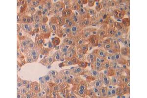 Used in DAB staining on fromalin fixed paraffin- embedded Kidney tissue (LYPLA1 抗体  (AA 1-230))