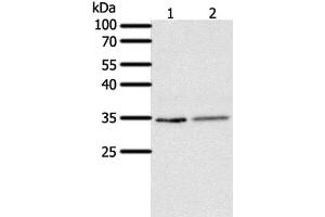 Western Blot analysis of Human fetal lung tissue and A549 cell using SFTPA1 Polyclonal Antibody at dilution of 1:300 (Surfactant Protein A1 抗体)