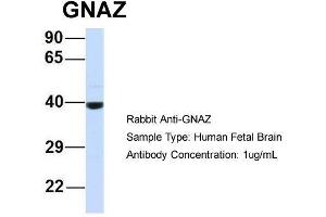 Host:  Rabbit  Target Name:  GNAZ  Sample Type:  Human Fetal Brain  Antibody Dilution:  1.