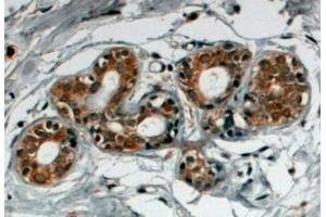 ABIN185147 (4µg/ml) staining of paraffin embedded Human Breast. (SNX5 抗体  (C-Term))