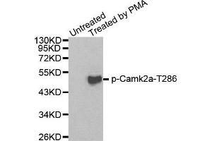 Western blot analysis of extracts from 293 cells using Phospho-Camk2a-T286 antibody. (CAMK2A 抗体  (pThr286))