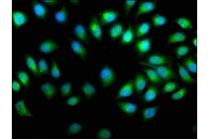 Immunofluorescence staining of A549 cells with ABIN7164792 at 1:50, counter-stained with DAPI. (PREP 抗体  (AA 539-691))