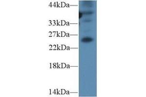Detection of GREM1 in Mouse Spleen lysate using Polyclonal Antibody to Gremlin 1 (GREM1) (GREM1 抗体  (AA 25-184))