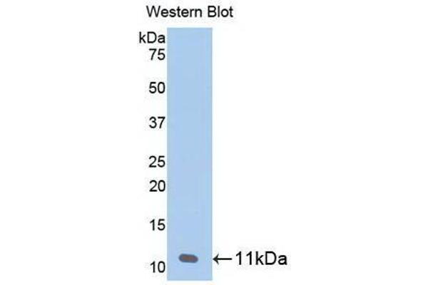 beta-Thromboglobulin 抗体  (AA 59-128)