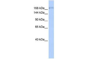 WB Suggested Anti-SUPT6H Antibody Titration: 0. (Spt6 抗体  (N-Term))
