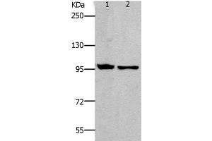 Western Blot analysis of HT-29 and SKOV3 cell using NFκB-p100 Polyclonal Antibody at dilution of 1:800 (NFKB2 抗体)