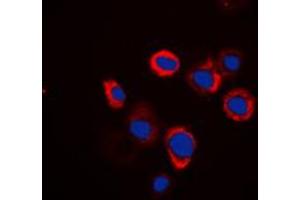 Immunofluorescence (IF) image for anti-ATPase, H+ Transporting, Lysosomal Accessory Protein 2 (ATP6AP2) (Center) antibody (ABIN7297736)
