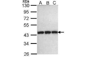 WB Image Sample (30 ug of whole cell lysate) A: 293T B: A431 , C: H1299 10% SDS PAGE antibody diluted at 1:1000 (PGK1 抗体)