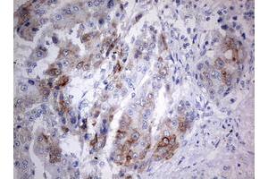 Immunohistochemistry (IHC) image for anti-Chromosome 3 Open Reading Frame 15 (C3orf15) (AA 1-313) antibody (ABIN2715591) (C3orf15 抗体  (AA 1-313))
