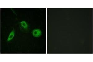 Immunofluorescence analysis of HeLa cells, using PLCG2 (Phospho-Tyr1217) Antibody. (Phospholipase C gamma 2 抗体  (pTyr1217))