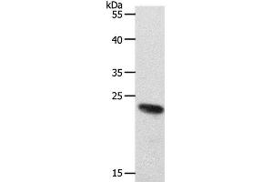 Western Blot analysis of 231 cell using RAMP2 Polyclonal Antibody at dilution of 1:650 (RAMP2 抗体)