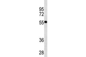 VDR antibody western blot analysis in MDA-MB453 lysate. (Vitamin D Receptor 抗体)