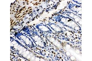 IHC-P: Lamin B2 antibody testing of rat intestine tissue (Lamin B2 抗体  (AA 580-597))