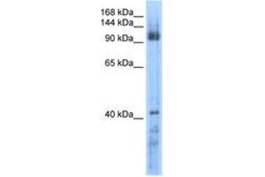 RECQL5 anticorps  (AA 431-480)