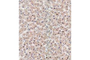 Immunohistochemical analysis of paraffin-embedded human liver tissue using (ABIN388518 and ABIN2849631) performed on the Leica® BOND RXm. (ATG5 抗体  (N-Term))