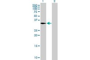 Western Blot analysis of CAPZA2 expression in transfected 293T cell line by CAPZA2 MaxPab polyclonal antibody.