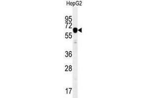 IGF2BP2 Antibody (C-term) western blot analysis in HepG2 cell line lysates (35µg/lane). (IGF2BP2 抗体  (C-Term))