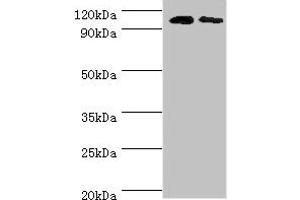 Western blot All lanes: Cytosolic 10-formyltetrahydrofolate dehydrogenase antibody at 8 μg/mL Lane 1: Mouse liver tissue Lane 2: Mouse gonad tissue Secondary Goat polyclonal to rabbit IgG at 1/10000 dilution Predicted band size: 99, 88, 100, 56 kDa Observed band size: 99 kDa (ALDH1L1 抗体  (AA 1-250))