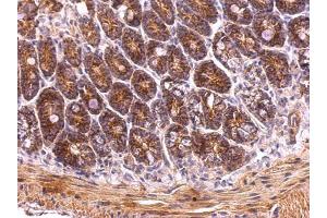 Immunohistochemistry (IHC) image for anti-TNF Receptor-Associated Protein 1 (TRAP1) antibody (ABIN2855258)