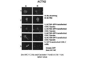 Sample Type :  ACTNX-GFP transfected COS-7 cells  Primary Antibody Dilution :  1:1000  Secondary Antibody :  Anti-rabbit-Alexa-Fluor 568  Secondary Antibody Dilution :  1:100  Color/Signal Descriptions :  Green: GFP Red: ACTN2  Gene Name :  ACTN2  Submitted by :  Johannes W. (ACTN2 抗体  (N-Term))