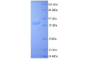 SDS-PAGE (SDS) image for Janus Kinase 3 (JAK3) (AA 818-110) protein (His tag) (ABIN5714372)