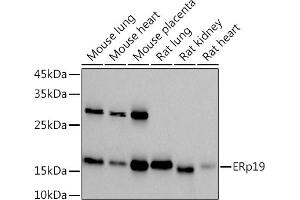 Western blot analysis of extracts of various cell lines, using (ABIN7270799) at 1:1000 dilution. (TXNDC12 抗体)