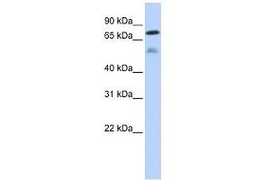 WB Suggested Anti-DUSP8 Antibody Titration: 0. (DUSP8 抗体  (Middle Region))