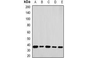 Western blot analysis of RPLP0 expression in A549 (A), K562 (B), Jurkat (C), mouse liver (D), mouse testis (E) whole cell lysates. (RPLP0 抗体)